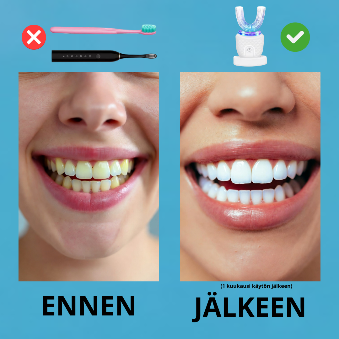 VALKEA SonicSense 360 Pro