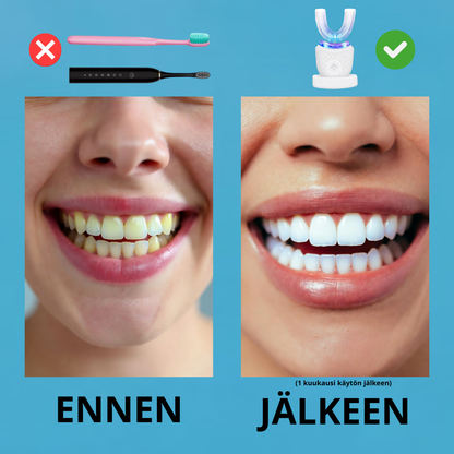 VALKEA SonicSense 360 Pro